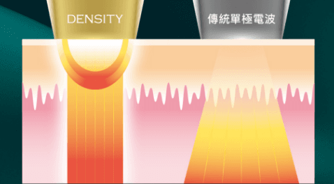 無雙電波與一般單極電波的作用深度示意:無雙同時作用於較深與較淺兩層