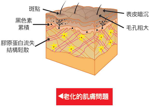 老化肌膚常見問題(斑點、暗沉、毛孔、膠原流失)示意圖