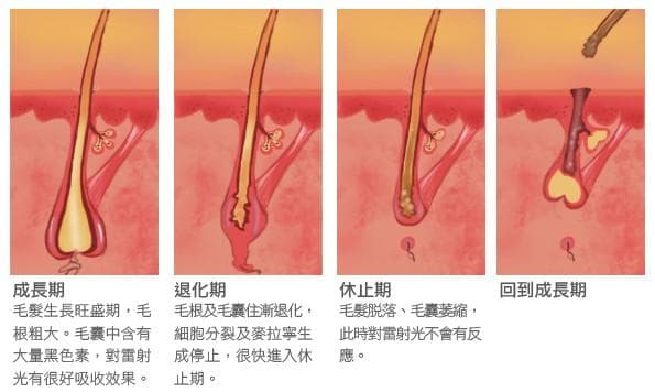 毛髮生長週期(成長期、退化期、休止期)示意圖